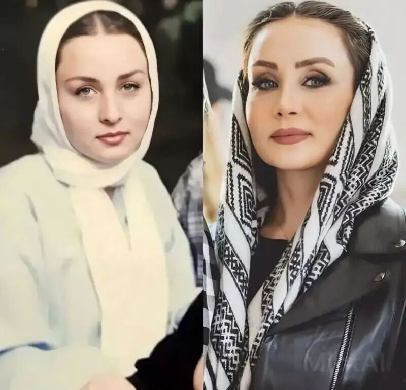 عمل زیبایی حدیث فولادوند